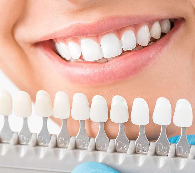 Cosmetic dentist procedure 4 cosmetic dentistry options that families frequently request
