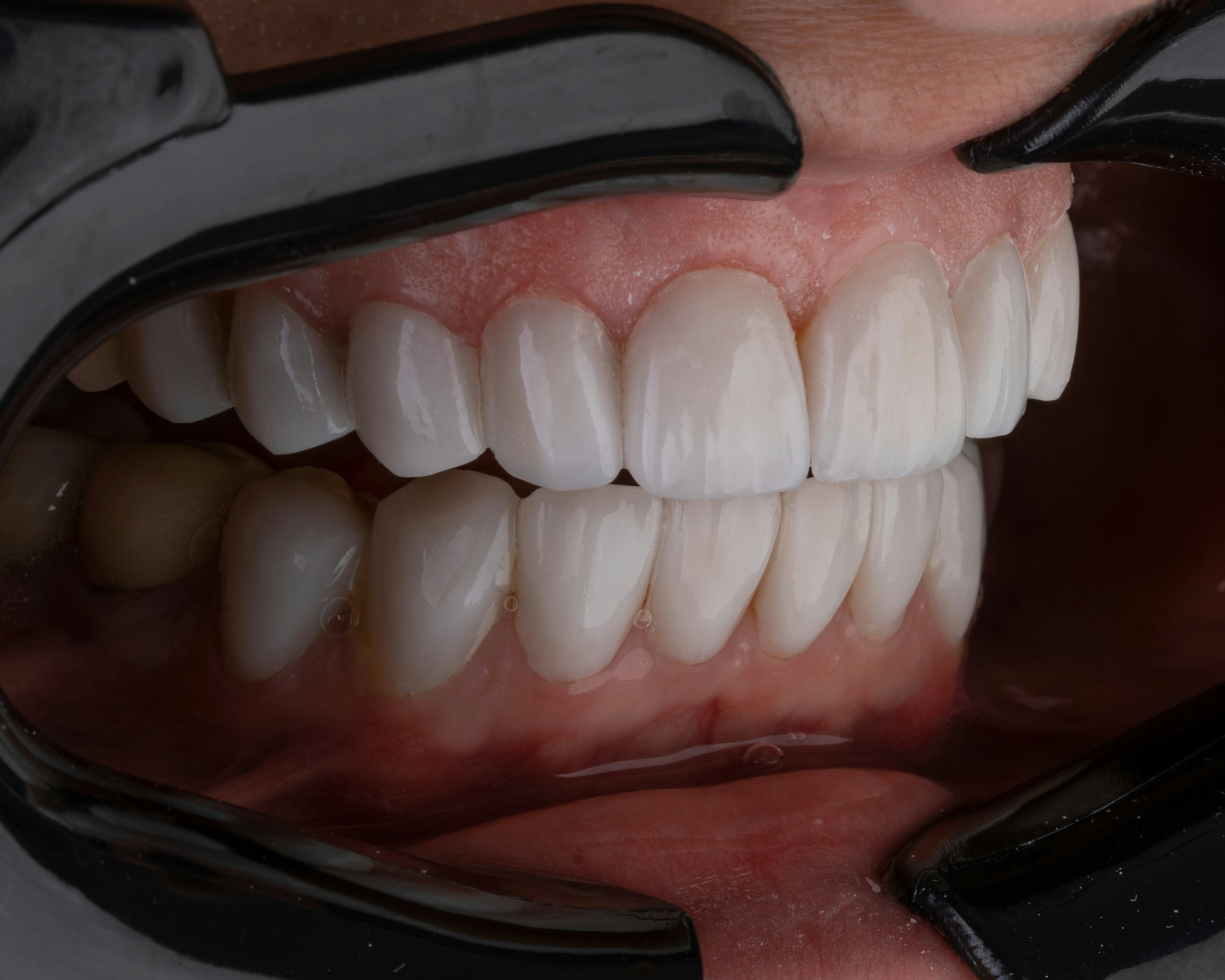 Kamal hoseinianzade s5tu52zjafa unsplash why preventive dentistry protects against gum disease and cavities