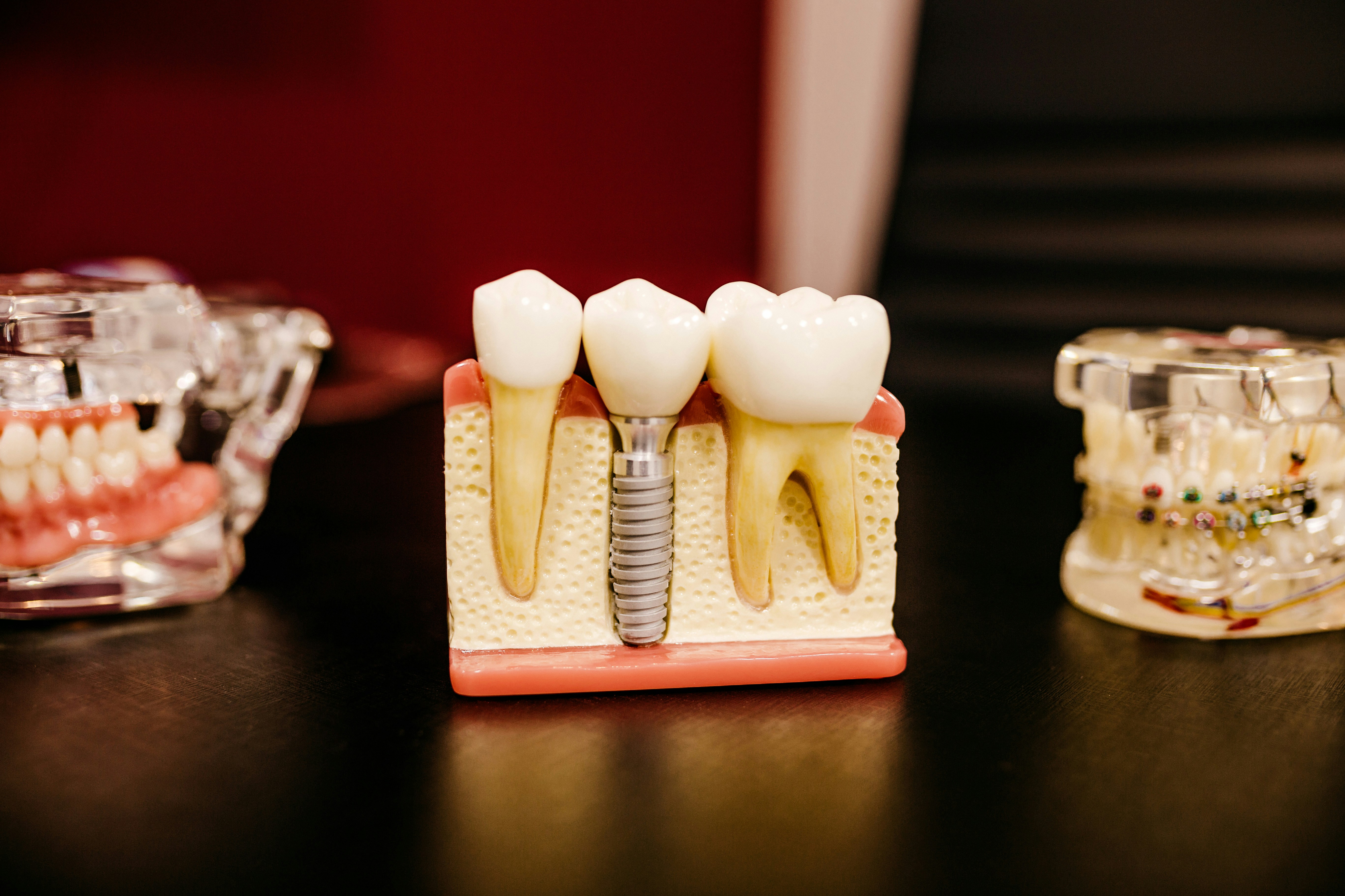 Jonathan borba w9yey6g8lvm unsplash how implant dentists use advanced technology for precision placement