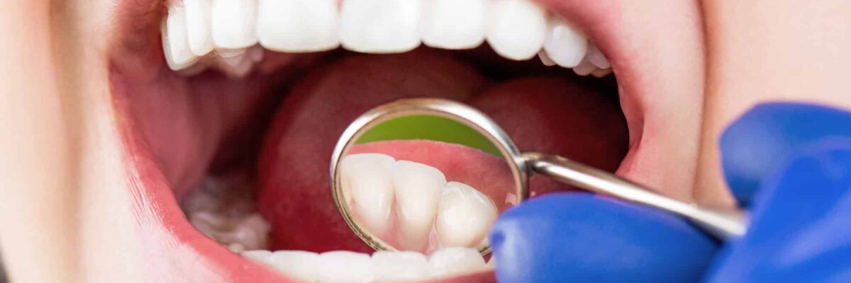 How General Dentistry Uses Modern Materials For Stronger Restorations