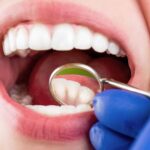 how general dentistry uses modern materials for stronger restorations