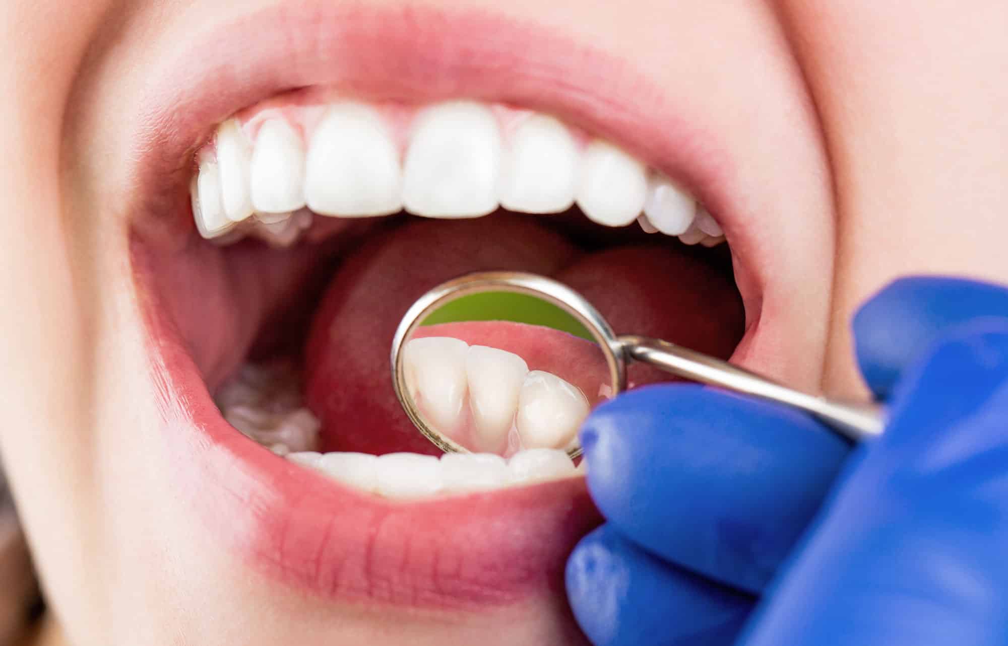 how general dentistry uses modern materials for stronger restorations