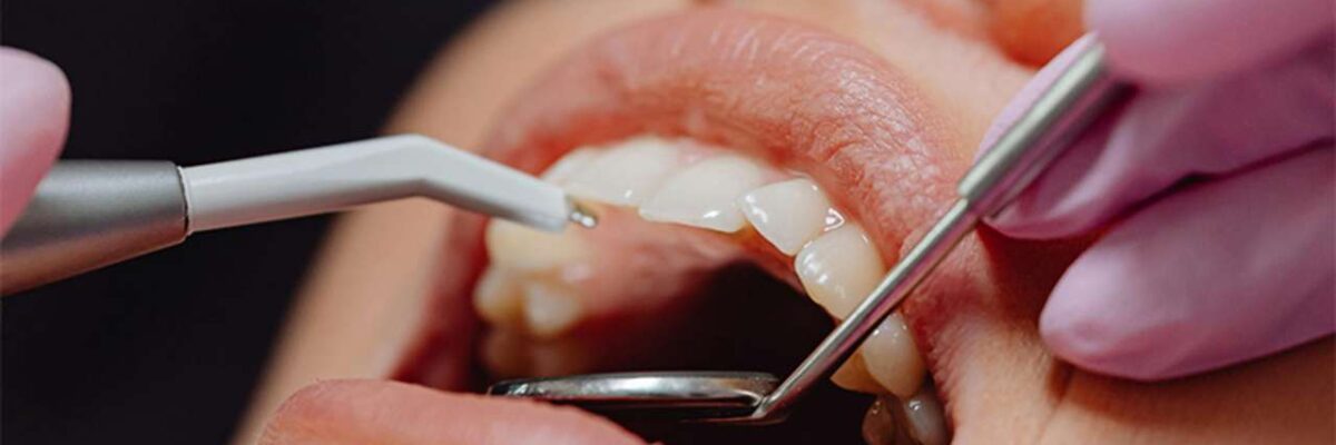 4 Ways Cosmetic Dentistry Can Enhance Routine Dental Care